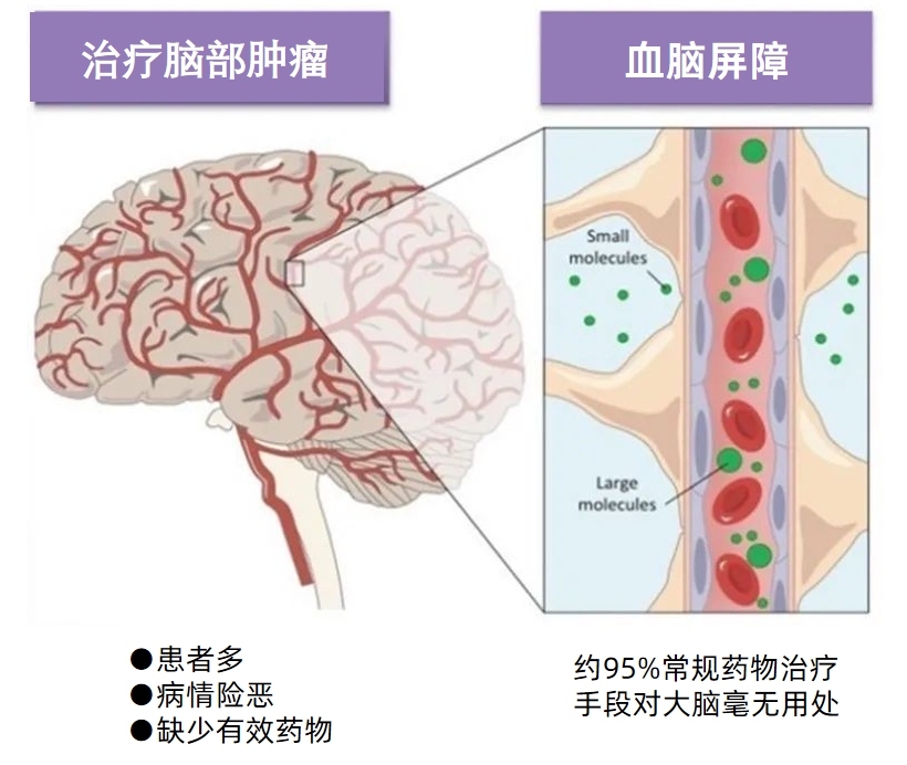 血脑屏障